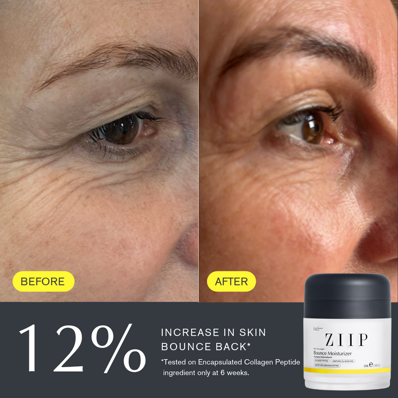 Before-and-after comparison of a person's eye area showing reduced wrinkles and improved skin elasticity, with text reading 12% INCREASE IN SKIN BOUNCE BACK and a small jar of ZIIP Bounce Moisturizer shown at the bottom right.