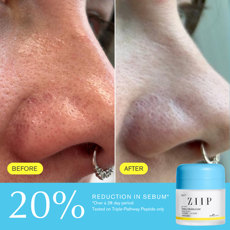 Detox Niacinamide Moisturizer
