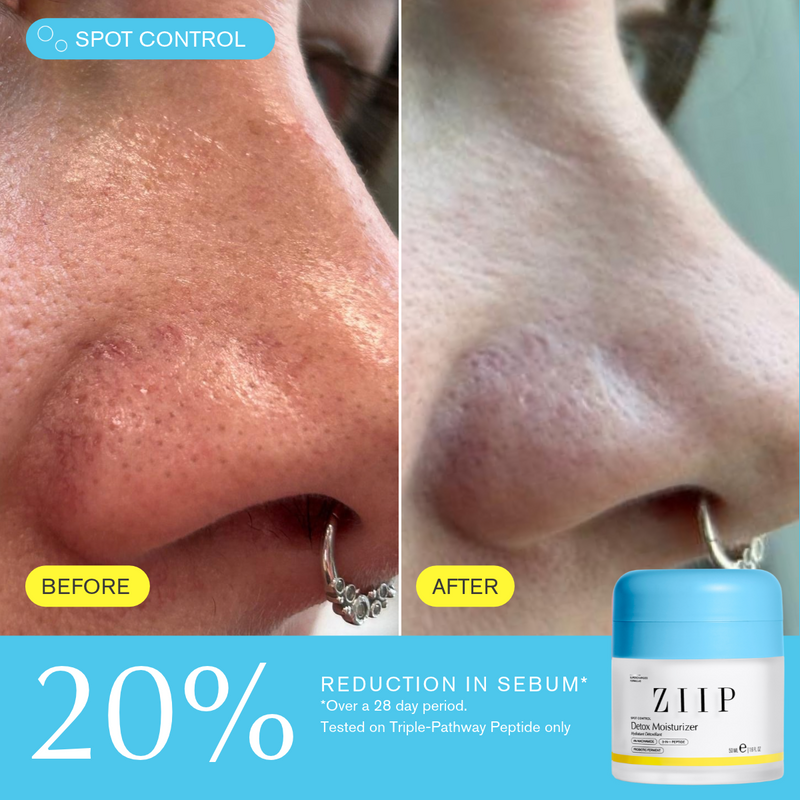 Detox Niacinamide Moisturizer