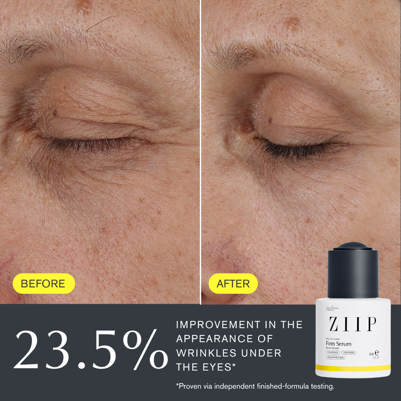 Firm serum before and afters with a statistic from independent testing