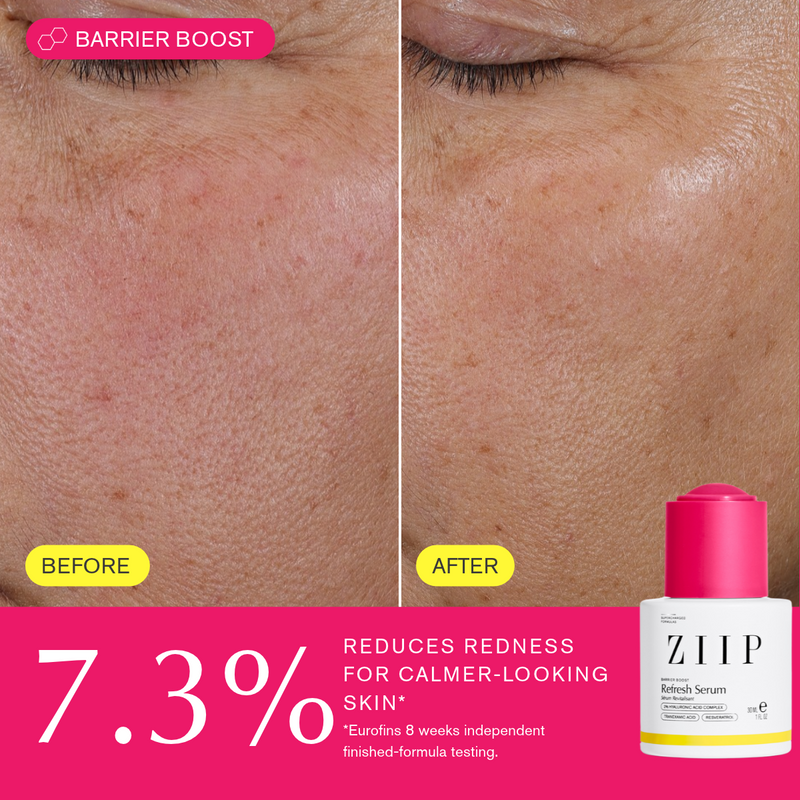 Refresh Tranexamic Acid Serum