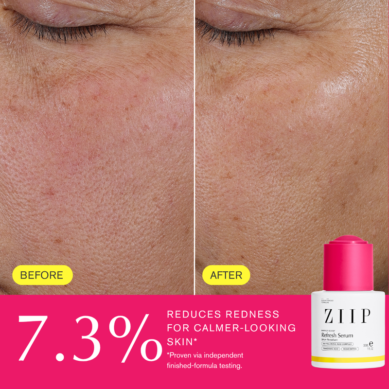 Refresh Tranexamic Acid Serum