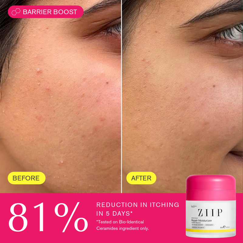 Repair Ceramide Moisturizer