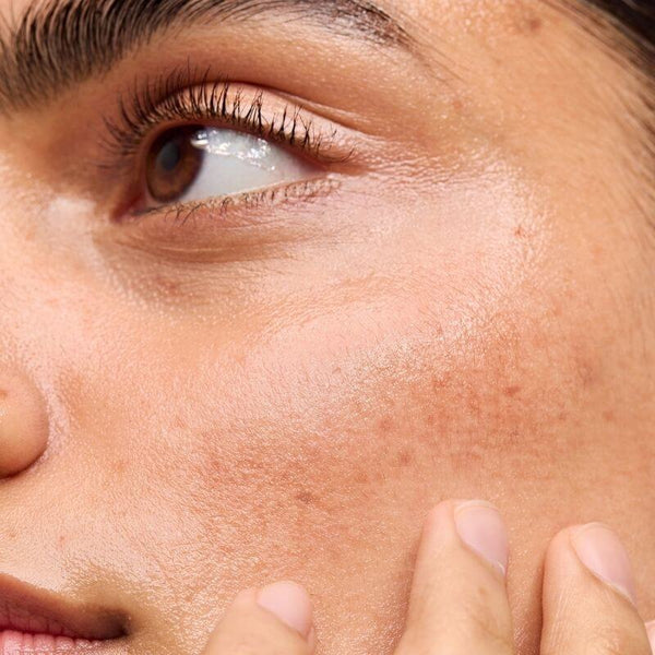 Skin health
