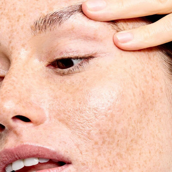 Skin prep